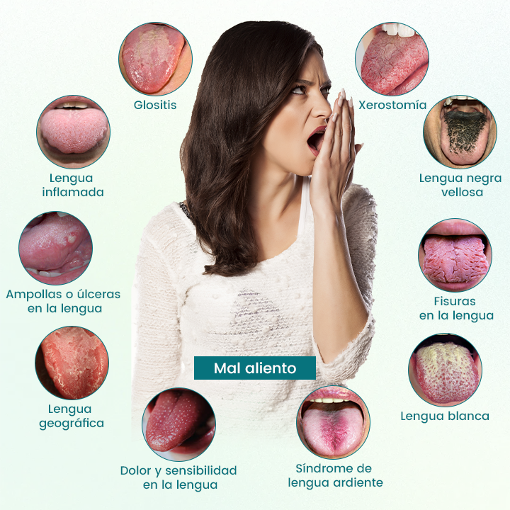 Timilk® GlosShield Spray Reparador de Lengua