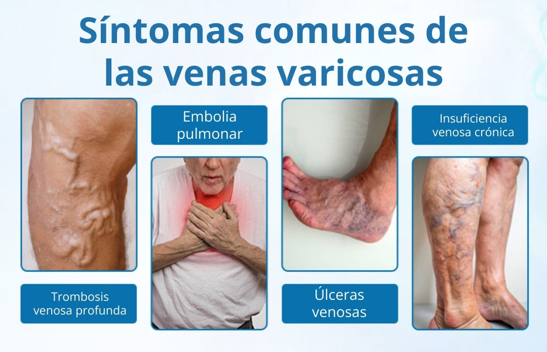 Timilk® VeinGuard Spray de Hierbas-✅ Clínicamente probado para eliminar las venas varicosas en solo 7 días.
