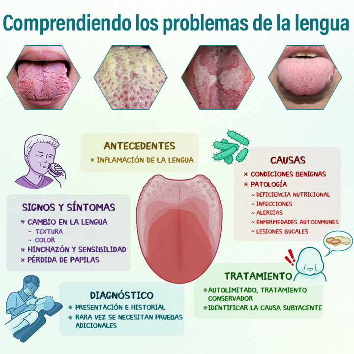 Timilk® GlosShield Spray Reparador de Lengua