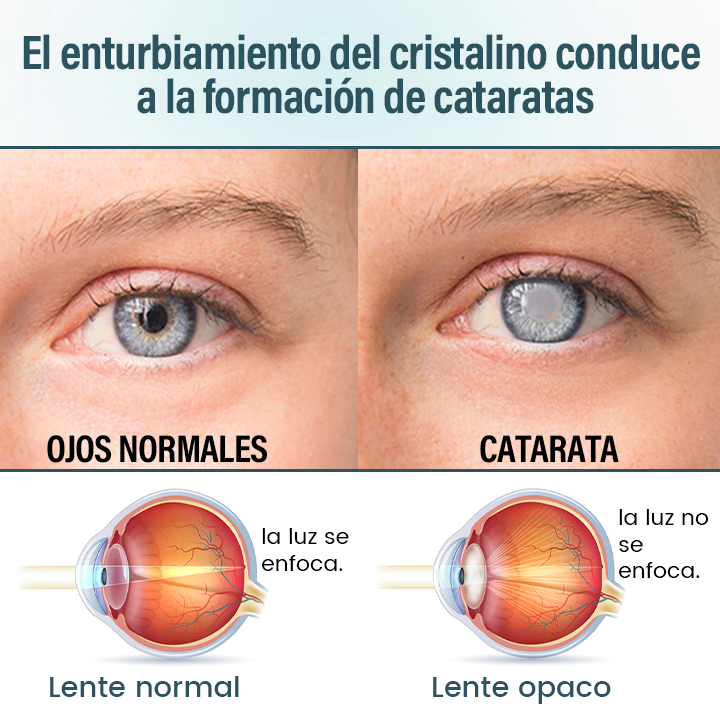 Timilk® OptiFusion Suero de Gotas Oftálmicas Nano