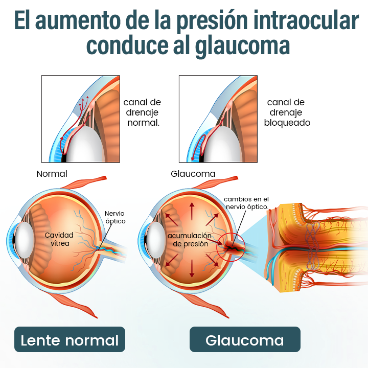 Timilk® OptiFusion Suero de Gotas Oftálmicas Nano