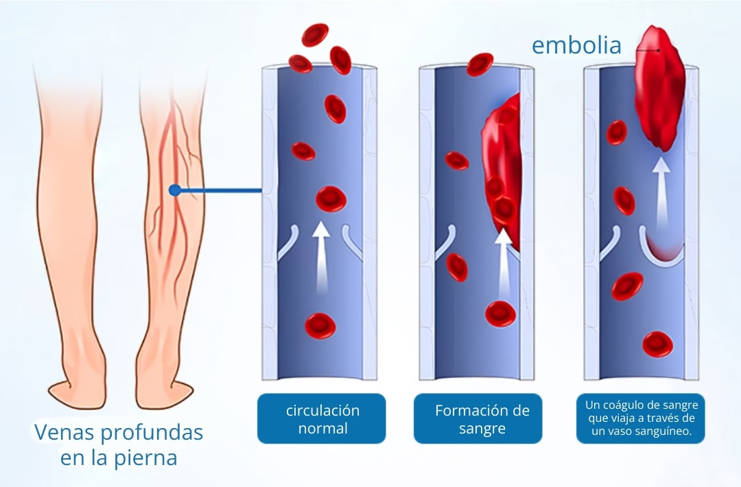 Timilk® VeinGuard Spray de Hierbas-✅ Clínicamente probado para eliminar las venas varicosas en solo 7 días.