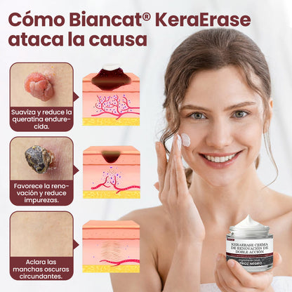 Biancat® KeraErase Crema renovadora de doble acción
