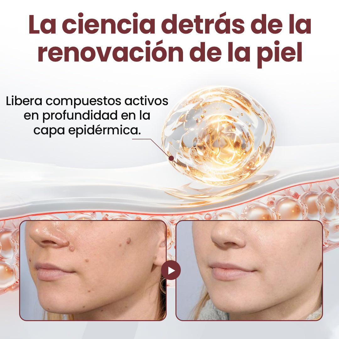 Biancat® KeraErase Crema renovadora de doble acción