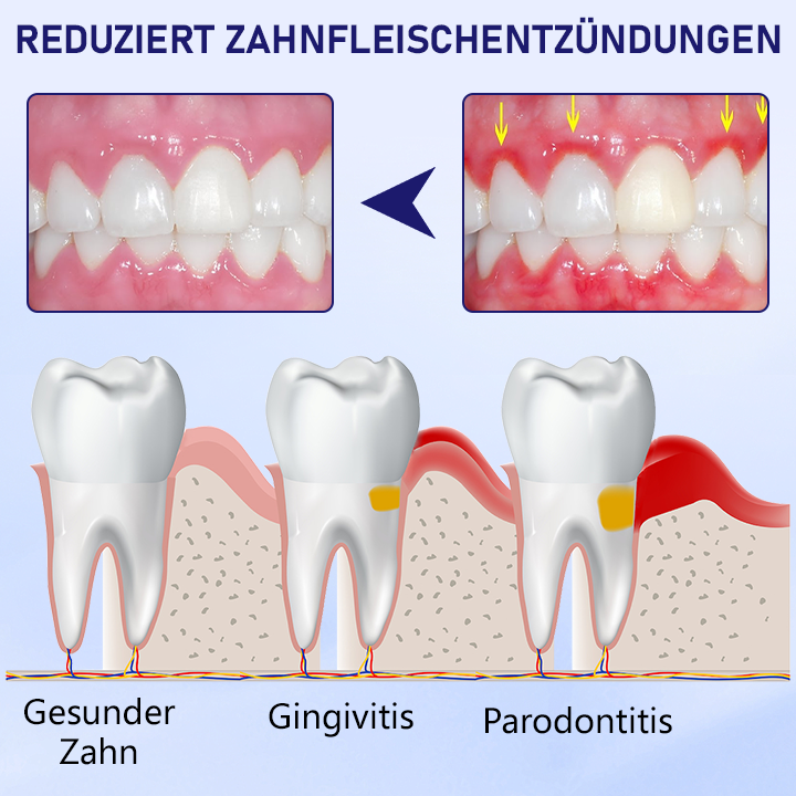 Ceoerty™ VenoSmile Bienengift Zahnreparatur-Zahnpasta 🦷✨