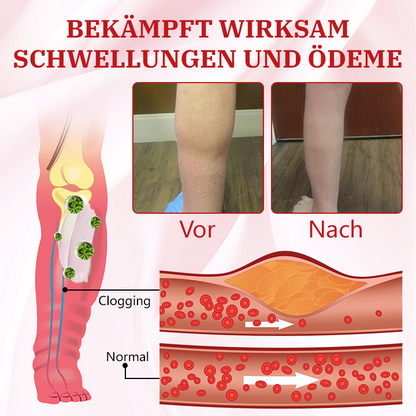 Ceoerty™ Aescinex Kräutermassagecreme zur Entlastung von Ödemen