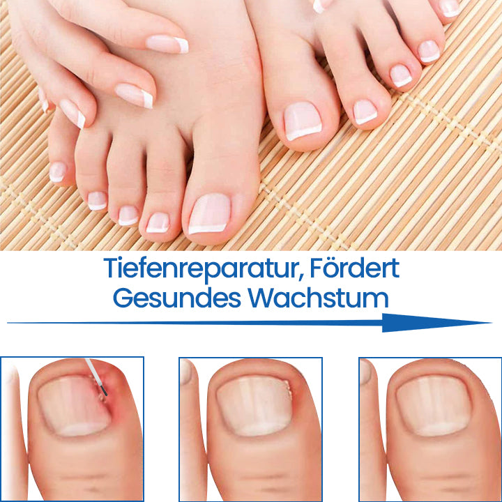 Ceoerty™ NailHeal: Kräuter-Nagelreparaturgel