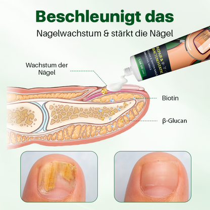 Biancat™ NailRegen Pilzbehandlung-Creme