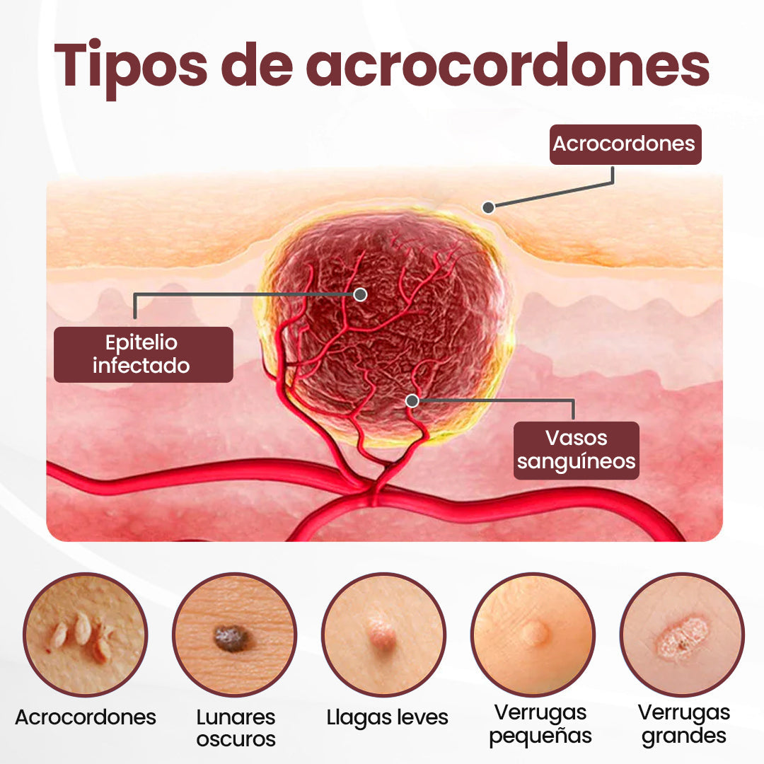 Biancat® KeraErase Crema renovadora de doble acción