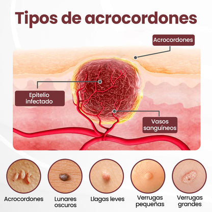 Biancat® KeraErase Crema renovadora de doble acción