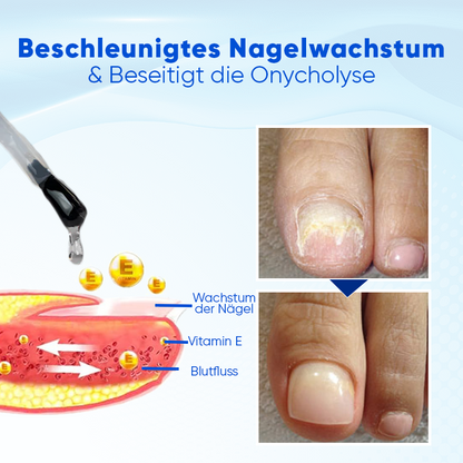 Biancat™ OnyxoGuard Nagelwachstums- und Reparaturs Serum