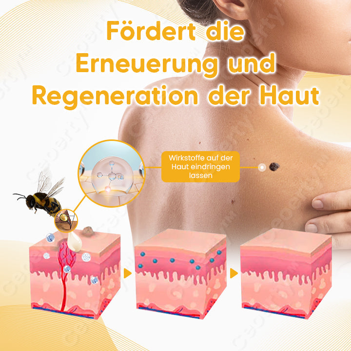 Ceoerty™ SpotErase Bienengift Maulwurf & Warze Entferner Creme