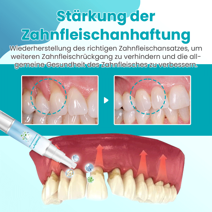 Ceoerty™ Zahnfleischschutz-Gel