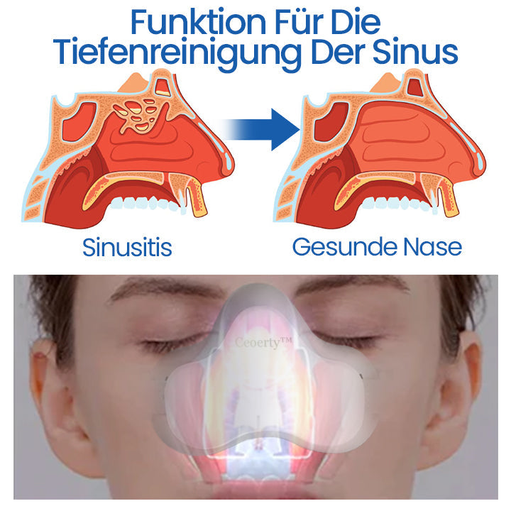 Ceoerty™ OptimaNasal Elite+ EMS-Nasentherapiegerät