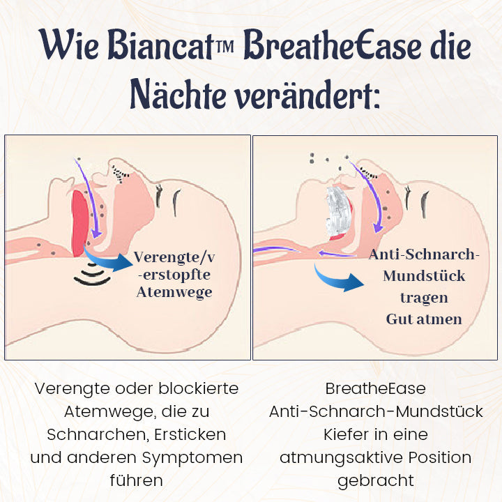 Biancat™ BreatheEase Anti-Schnarch-Mundstück