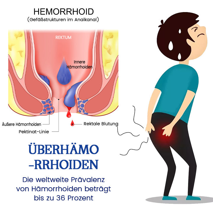 Biancat™ AnalEase Hämorrhoiden-Reparatur Kräuterkapseln🌿🌿