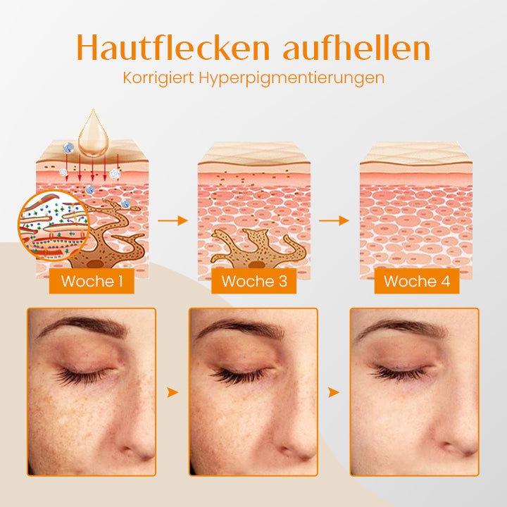 Ceoerty™ SpotCorrector Kurkuma-Gesichtsserum