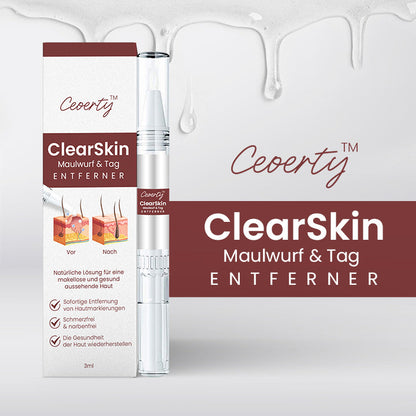 Ceoerty™ ClearSkin Maulwurf & Tag Entferner