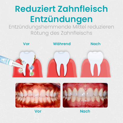 Ceoerty™ Zahnfleischschutz-Therapie-Gel