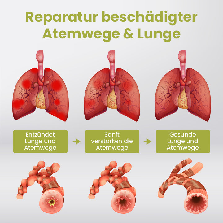 Ceoerty™ PURELung Kräuter-Spray zur Unterstützung der Atemwege