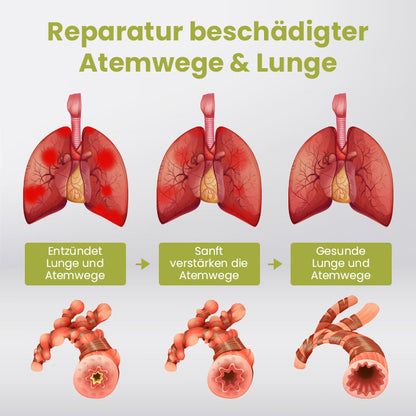 Ceoerty™ PURELung Kräuter-Spray zur Unterstützung der Atemwege