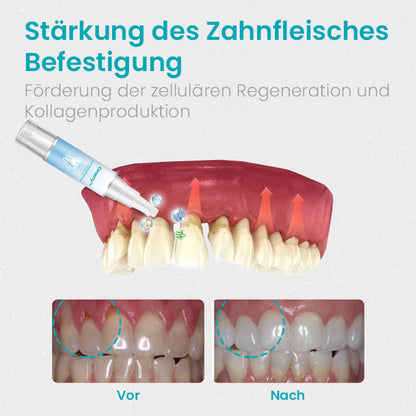 Ceoerty™ Zahnfleischschutz-Therapie-Gel